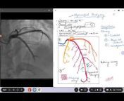 White Board and Marker Cardiology Lectures