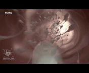 Dandelion Medical Animation