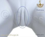 Plastische Chirurgie München Prof. hc. Dr. Stefan Gress