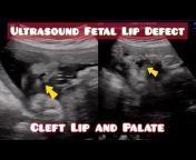 KASHIF Ultrasound - made EASY Cases