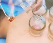 Chinese medicine practitioners have been using cupping for thousands of years to treat a wide range of health problems. It is designed to help the body reduce inflammation by using suction. Think of it kind of like getting a massage in reverse.