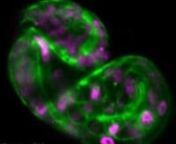 Rapid muscle contractions in a C. elegans embryo in the three-fold stage, with labeled GFP-PH domains (green) and mCherry-histones (magenta), as recorded in a single 2D optical section at 50 frames/sec.Scale bar, 10 μm.nnCredit: Betzig Lab, HHMI/Janelia Research Campus, Seydoux Lab, HHMI/Johns Hopkins University; 10/24/14 issue of the journal Science.nnFor more information, see http://www.hhmi.org/news/new-microscope-collects-dynamic-images-molecules-animate-life