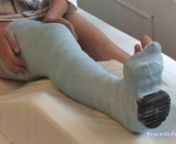Paula BLUE Plaster Long Leg Cast from long leg cast