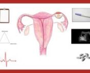 Vaginal bleeding P2: Ectopic Pregnancy from vaginal