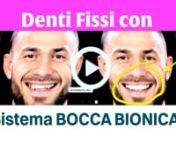 Denti Fissi sistema Bocca Bionica from bionica