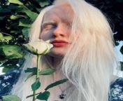 Credit: SWNS / Fleur Van Der Ven&#60;br/&#62;&#60;br/&#62;A woman bullied for being albino has embraced her pale skin and white hair and says kids now often mistake her for Elsa from Frozen. &#60;br/&#62;&#60;br/&#62;Fleur Van Der Ven, 20, didn&#39;t realise she was different until she was seven and other children started to avoid her - cruelly calling her a vampire and a ghost. &#60;br/&#62;&#60;br/&#62;She claims she was picked on for her appearance - which left her dyeing her locks dark brown and coating her white eyelashes in black mascara.&#60;br/&#62;&#60;br/&#62;But at the age of 15, Fleur learnt to embrace her albinism and stopped dyeing her hair and wearing a full face of make-up. &#60;br/&#62;