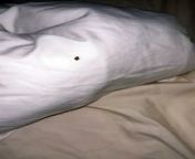 Mum horrified after finding bed bugs in Blackpool guest house from www murder3 hot bed scene com x