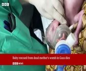 Tragic news emerges from Gaza as a newborn baby, miraculously saved from their mother&#39;s lifeless womb, has passed away. The poignant story unfolds against the backdrop of conflict and despair in the region, shedding light on the harsh realities faced by civilians amidst ongoing turmoil.&#60;br/&#62;&#60;br/&#62;The harrowing tale began with the untimely death of the infant&#39;s mother, a victim of the violence that has engulfed Gaza. In a remarkable feat of medical intervention, doctors managed to deliver the baby via emergency cesarean section, offering a glimmer of hope amid the darkness of tragedy.&#60;br/&#62;&#60;br/&#62;However, despite the valiant efforts of healthcare professionals, the fragile newborn succumbed to the challenges of life outside the womb, underscoring the fragility of existence in a war-torn environment.&#60;br/&#62;&#60;br/&#62;This heart-wrenching incident serves as a stark reminder of the human toll exacted by conflict, as innocent lives are irrevocably altered and futures shattered. As the world mourns the loss of this innocent soul, the plight of the people of Gaza resonates with renewed urgency, calling for an end to the cycle of violence and a renewed commitment to peace and humanitarian aid.&#60;br/&#62;&#60;br/&#62;Stay tuned to BBC 2.0 News for further updates on this developing story and its implications for the region.