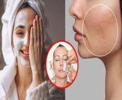 Face clean up: महिलाएं चेहरे की खूबसूरती को बढ़ाने के लिए कई तरह के ब्यूटी ट्रीटमेंट लेती हैं। इन ब्यूटी ट्रीटमेंट में फेशियल और क्लीनअप जैसी चीजें शामिल हैं। इससे चेहरे की चमक को बढ़ाया जाता है। साथ ही स्किन में मौजूद गंदगी को साफ करने में मदद मिल सकती है। खासतौर पर क्लीनअप कराने से चेहरे की रंगत को बेहतर करने में मदद मिल सकती है। अगर आप चाहते हैं कि आपकी खूबसूरती पर चार चांद लगे तो क्लीनअप कराने के बाद कुछ बातों का ध्यान जरूर रखें। अगर आप इन बातों का ध्यान नहीं रखते हैं, तो इससे चेहरे की खूबसूरती बिगड़ सकती है। आइए जानते हैं क्लीनअप के बाद किन गलतियों से बचना चाहिए? &#60;br/&#62; &#60;br/&#62;Face clean up: Women take many types of beauty treatments to enhance the beauty of their face. These beauty treatments include things like Facial and cleanup. This enhances the glow of the face. It can also help in clearing the dirt present in the skin. Especially getting a cleanup done can help in improving the complexion of the face. If you want your beauty to be enhanced then keep a few things in mind after cleaning. If you do not take care of these things, it can spoil the beauty of your face. Let us know which mistakes should be avoided after cleanup? &#60;br/&#62; &#60;br/&#62;#cleanupkebaadkyanahikarnachahiye #cleanupkebadkyachehreparlaganachahiye #cleanupkebadkyanahinkarnachahie &#60;br/&#62;~PR.111~HT.318~ED.120~