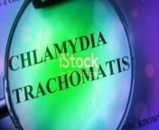 In this informative video, we delve into the topic of Chlamydia, covering its symptoms and treatment based on medical facts.&#60;br/&#62;&#60;br/&#62;Chlamydia is a common sexually transmitted infection that can have serious repercussions if left untreated. Understanding its symptoms and seeking timely treatment are crucial.&#60;br/&#62;&#60;br/&#62;Watch the video to learn more about the signs of Chlamydia and the effective treatment options available.&#60;br/&#62;&#60;br/&#62;If you find this video helpful, don&#39;t forget to give it a like and share it with others who may benefit from this information. Stay informed and take charge of your health!