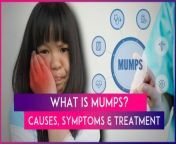 Delhi-NCR and many other places are witnessing a significant rise in cases of mumps. It is a contagious viral infection primarily affecting children and even some adults. Mumps virus, or paramyxovirus, is transmitted through respiratory droplets or direct contact with an infected person&#39;s saliva. The rise in cases is due to crowded living conditions, insufficient vaccination rates and substandard hygiene practices. Mumps can lead to several complications including pancreatitis, meningitis, encephalitis, &amp; myocarditis, especially in those who have not received the vaccine. Watch the video to know about its causes, symptoms and treatment.&#60;br/&#62;